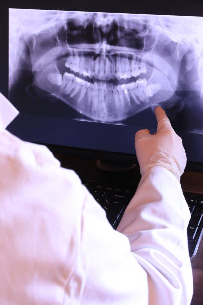 Best Emergency Dental Care for Broken or Chipped Teeth in Orland, CA